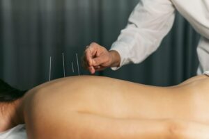 Best Acupuncture Services