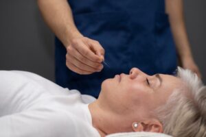 Acupuncture for Stress and Anxiety